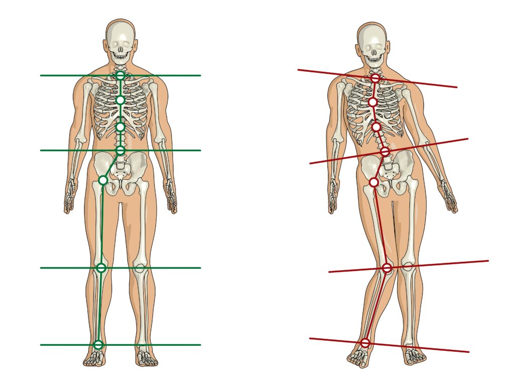 Toorak Chiropractor Spinal Misalignment